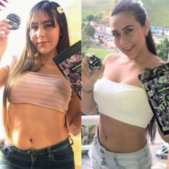 Mujer con tratamiento en la mano antes con sobrepeso y después con cuerpo definido